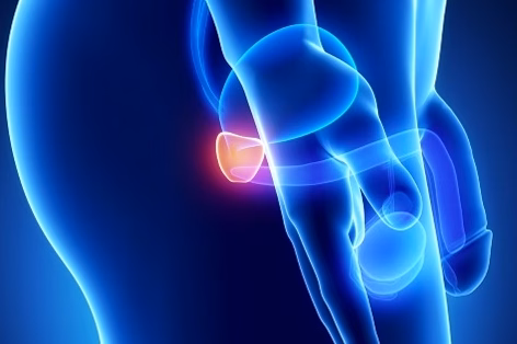 Douleurs musculaires après prothèse de hanche : causes et solutions